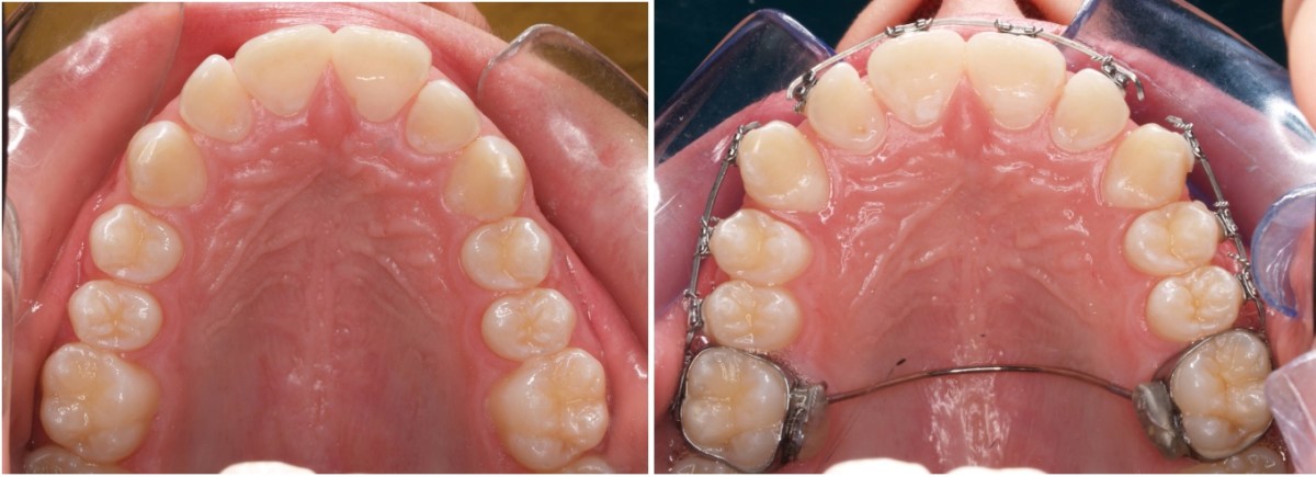 How Dental Surgery Can Help Improve Your Health and&nbsp;Well-Being